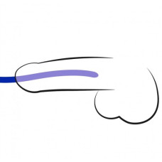 Набор силиконовых уретральных бужей Dilator Set